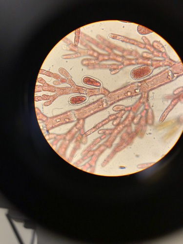 Image of Alternate Skein (Pleonosporium vancouverianum) by (c) Bridgette Clarkston, some rights reserved (CC BY-SA)