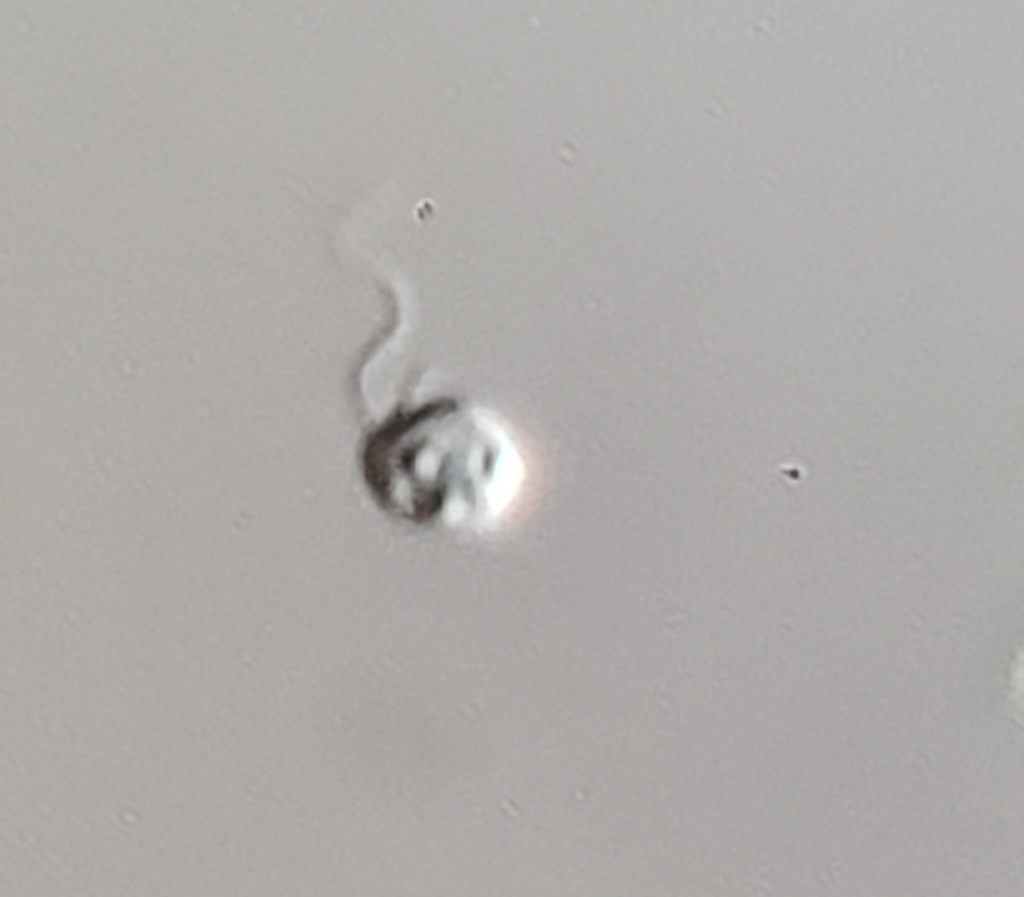 Spumella vulgaris