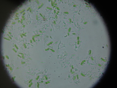 Chaenotheca xyloxena