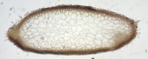 Palisada parvipapillata