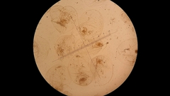 Noctiluca scintillans