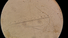 Noctiluca scintillans