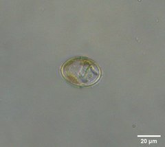 Cocconeis