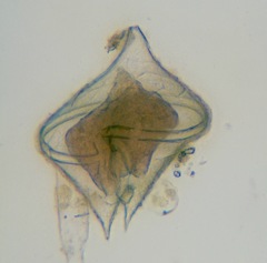 Protoperidinium depressum
