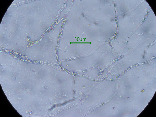 Representative image of Ulvella leptochaete