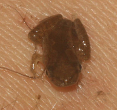 Microhyla