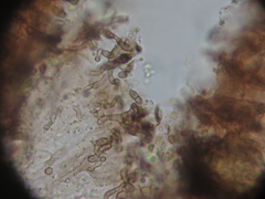 Intralichen christiansenii