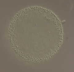 Coelosphaerium