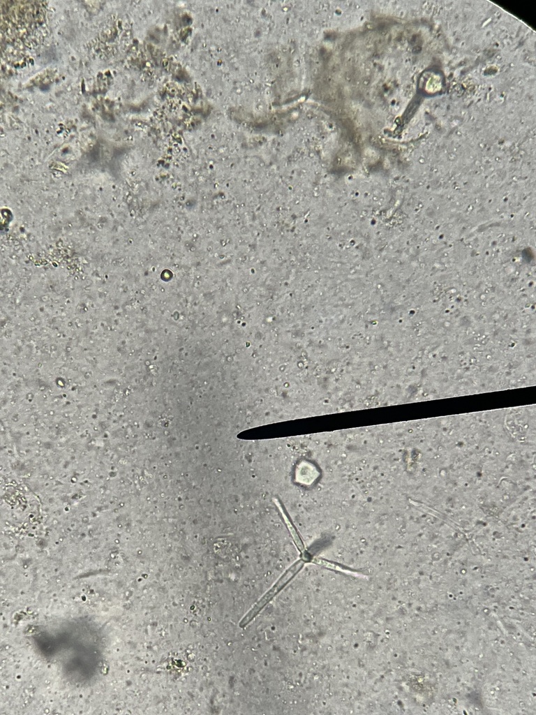 Lemonniera alabamensis