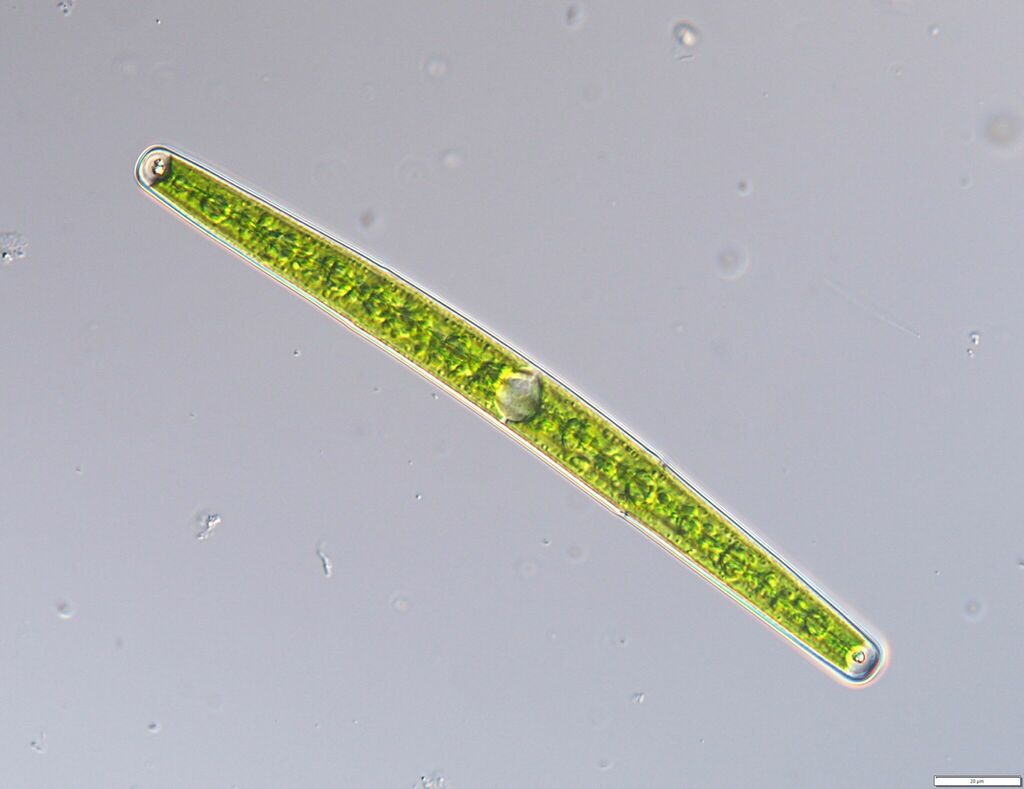 Closterium directum