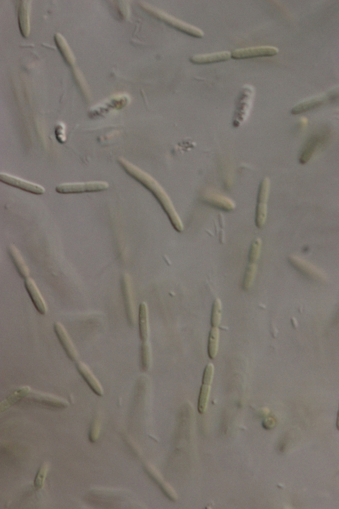 Rhabdoderma