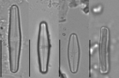 Achnanthidium minutissimum