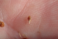 Rhynchospora gracilenta