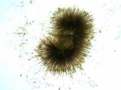 Gloeotrichia echinulata