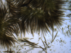 Gloeotrichia echinulata