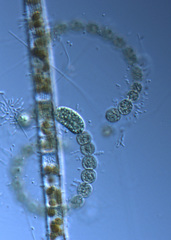 Dolichospermum crassum