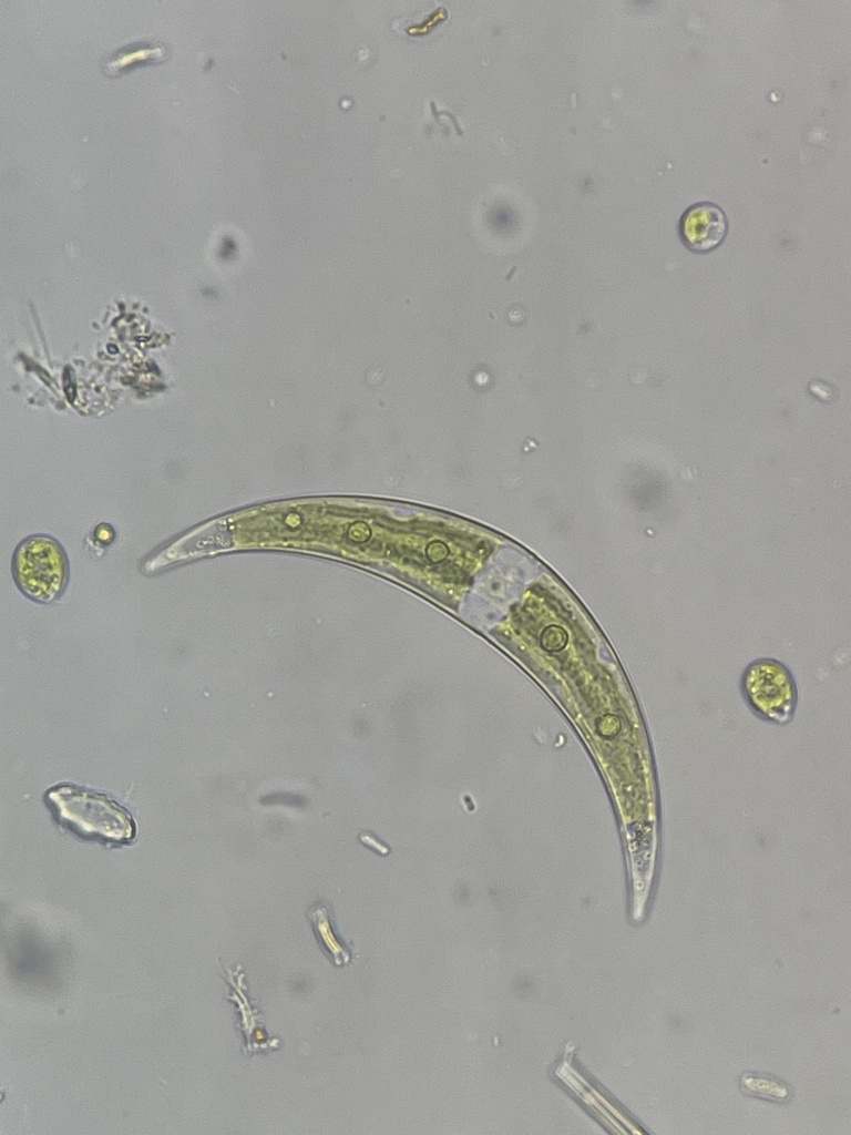 Closterium tumidulum