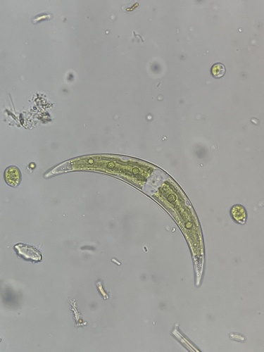 Closterium tumidulum
