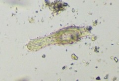 Chaetonotida