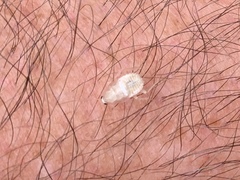 Ectobius vittiventris