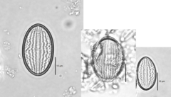 Cocconeis placentula