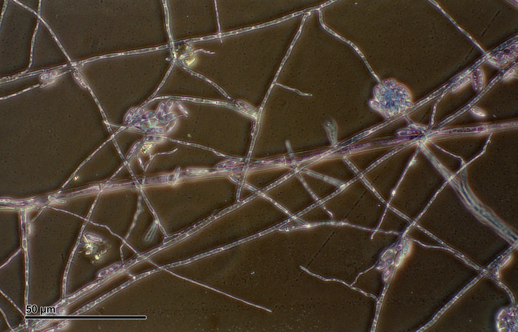 Neocosmospora solani