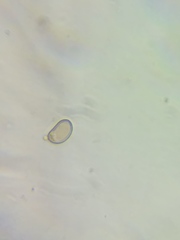 Pseudosperma friabile
