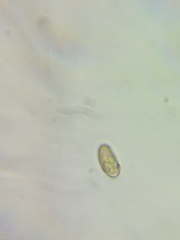 Pseudosperma friabile