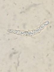 Hysterium angustatum