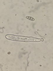 Hysterium angustatum