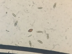 Hysterium angustatum