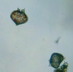 Protoperidinium