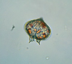 Protoperidinium