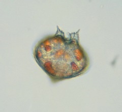 Protoperidinium