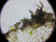 Intralichen lichenicola