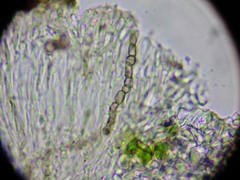 Intralichen lichenicola