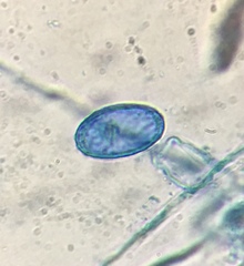 Scutellinia olivascens
