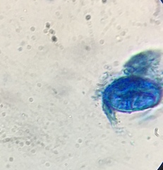Scutellinia olivascens