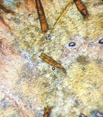 Scutellinia olivascens