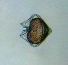Protoperidinium