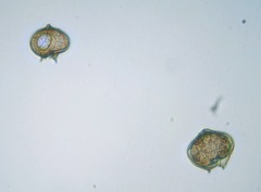 Protoperidinium