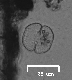 Desmidiaceae