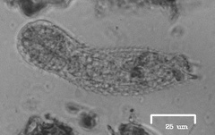 Gastrotricha