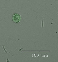 Pseudopediastrum boryanum