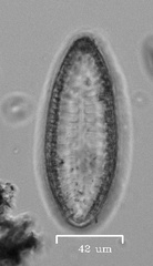 Surirella