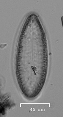 Surirella