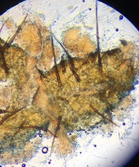 Scutellinia olivascens