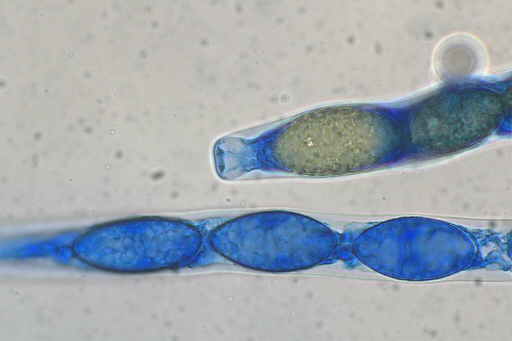 Gelasinospora