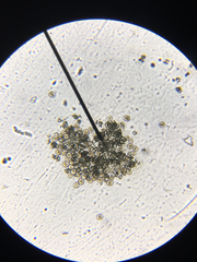 Anabaena