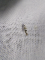 Argyresthia brockeella